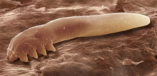 Demodex folliculorum