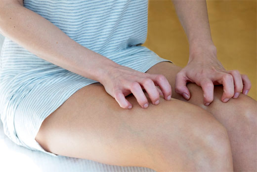 SINDROME DE LAS PIERNAS CANSADAS