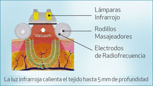 ELIGHT: VELASLIM