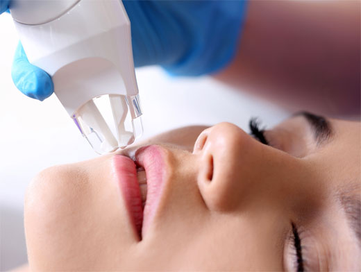 ENDERMOLOGIA FACIAL