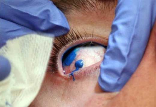 Tatuaje de ojos