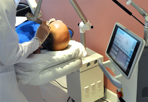 ROSTRO MASCULINO - LASER