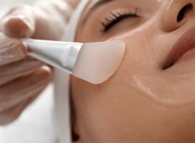 Peeling de fenol